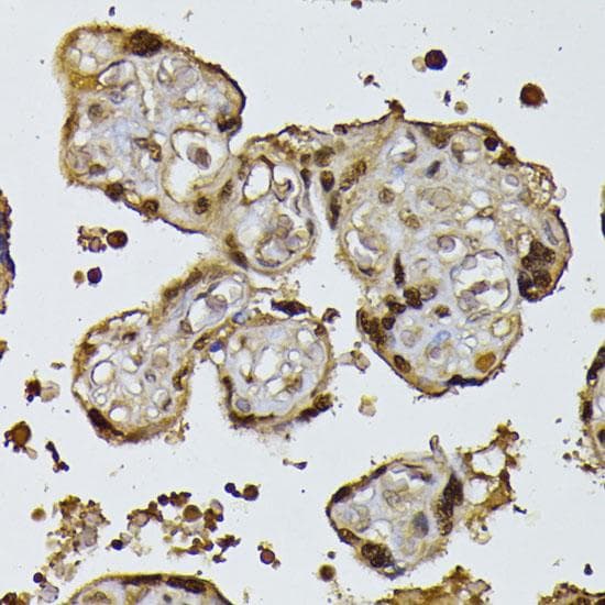 Polyclonal Rabbit anti-Human RPS27A Antibody (IHC)