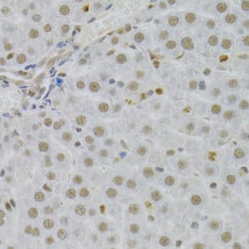 SFN / Stratifin / 14-3-3 Sigma Antibody