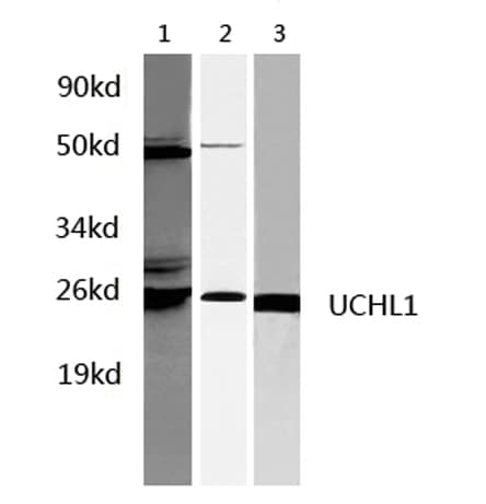 Polyclonal Rabbit anti-Rat UCHL1 / PGP9.5 Antibody (WB)