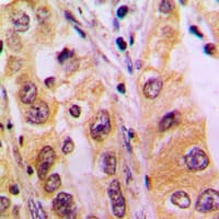 SURF1 Antibody (Internal)