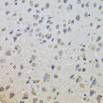 Polyclonal Rabbit anti-Human EGFR Antibody (IHC, IF, WB)