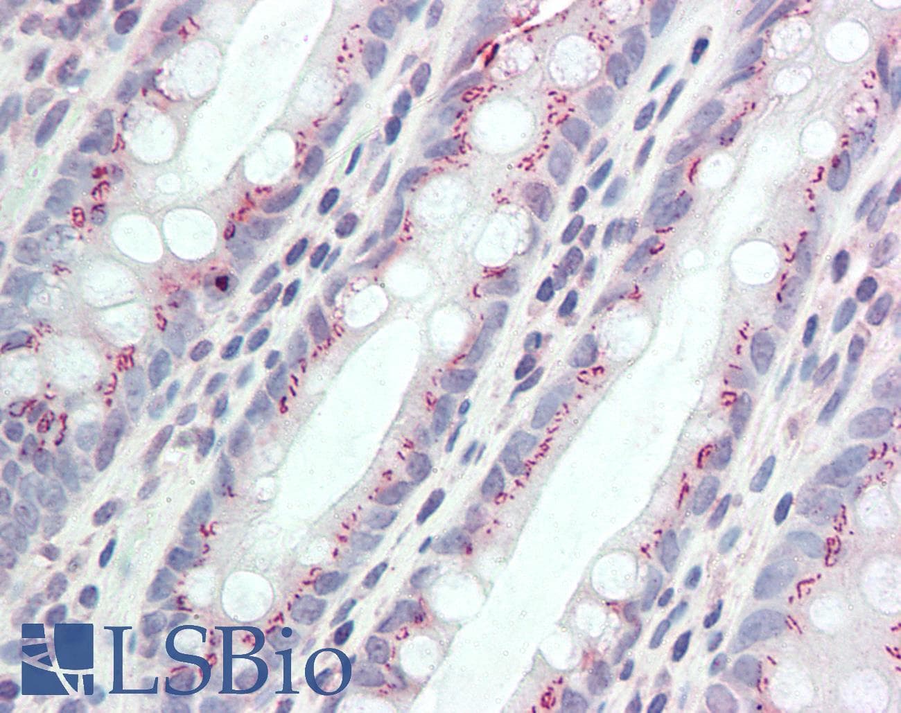 IHC-plus™ Polyclonal Goat anti-Human CCDC3 Antibody (aa134-148, IHC, WB)