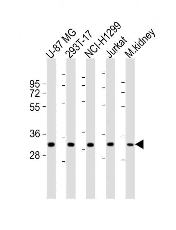 FN3KL / FN3KRP Antibody (aa24-58)