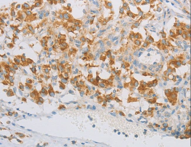 REN / Renin 1 Antibody