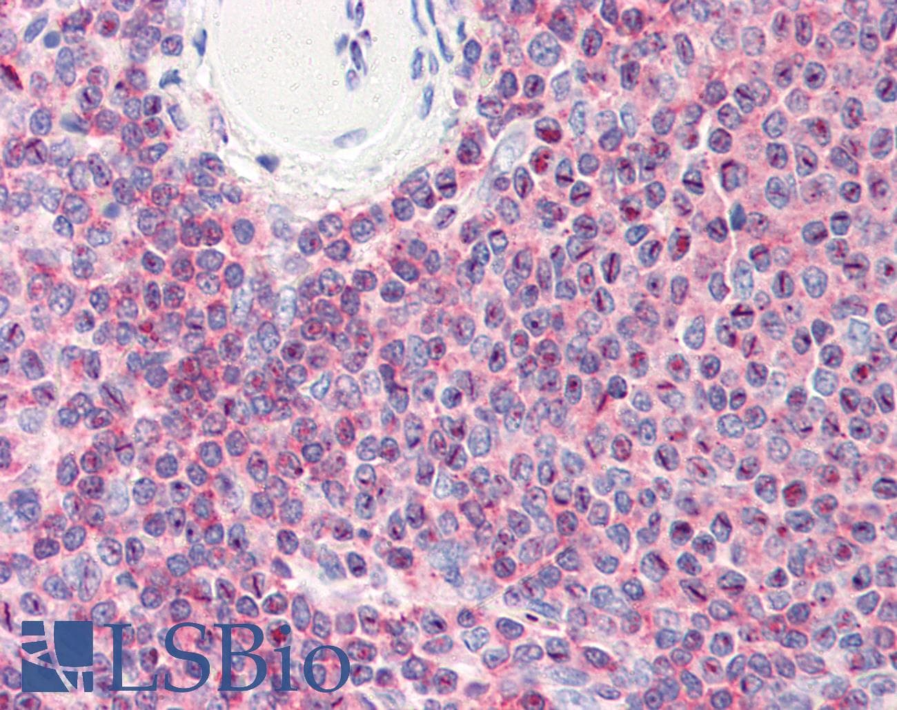 IHC-plus™ Monoclonal Mouse anti-Human CFL1 / Cofilin Antibody (clone AT1C1, aa1-166, IHC, WB)