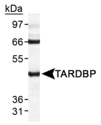 TDP-43 / TARDBP Antibody (C-Terminus, DY488)