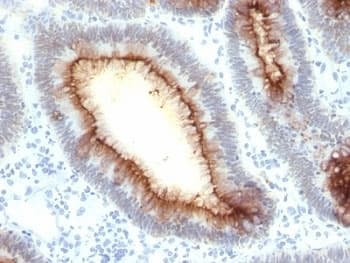 CEA / Carcinoembryonic Antigen Antibody (clone SPM330)
