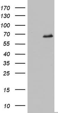 IKZF3 / AIOLOS Antibody (aa1-301, clone OTI5H2)