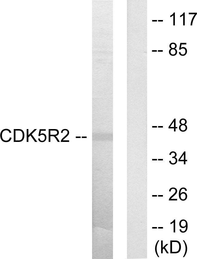 Polyclonal Rabbit anti-Human CDK5R2 Antibody (WB)