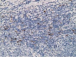 ADH2 / ADH1B Antibody (clone OTI1C3)