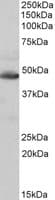 IHC-plus™ IDH2 Antibody (aa418-429)