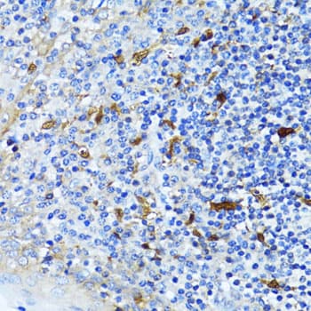 Polyclonal Rabbit anti-Human CTNNB1 / Beta Catenin Antibody (IHC, WB)