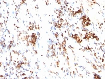 CDKN1B / p27 Kip1 Antibody (clone DCS-72.F6)