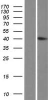 HYKK / AGPHD1 Protein (Over-Expression Lysate Myc-DDK (Flag))