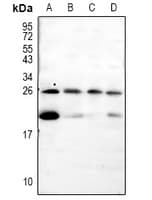 PTN / Pleiotrophin Antibody