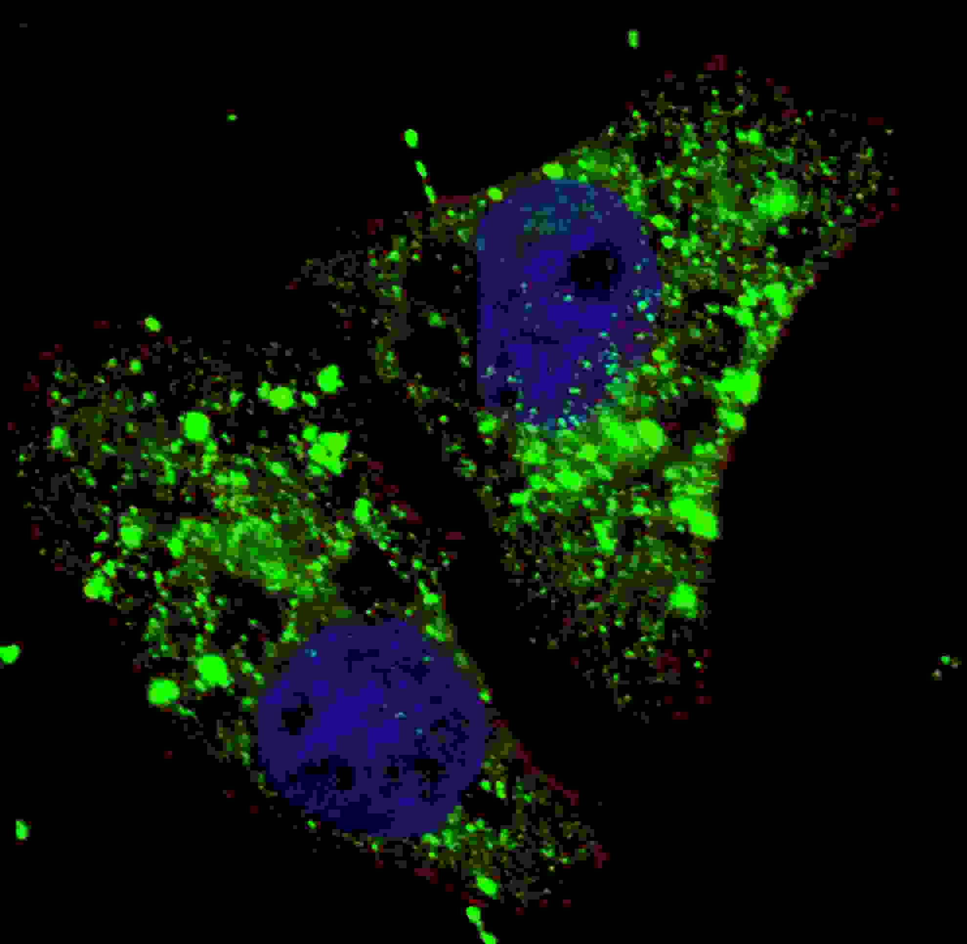 Polyclonal Rabbit anti-Human MAP1LC3A / LC3A Antibody (aa89-120, IHC, IF, WB)