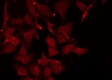 CA14 / Carbonic Anhydrase XIV Antibody