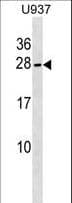NKIRAS2 Antibody (aa36-64)