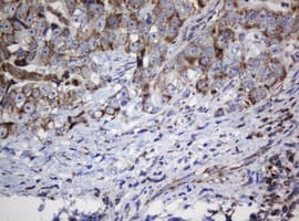 Monoclonal Mouse anti-Human NDUFB10 Antibody (clone OTI2G1, IHC, WB)
