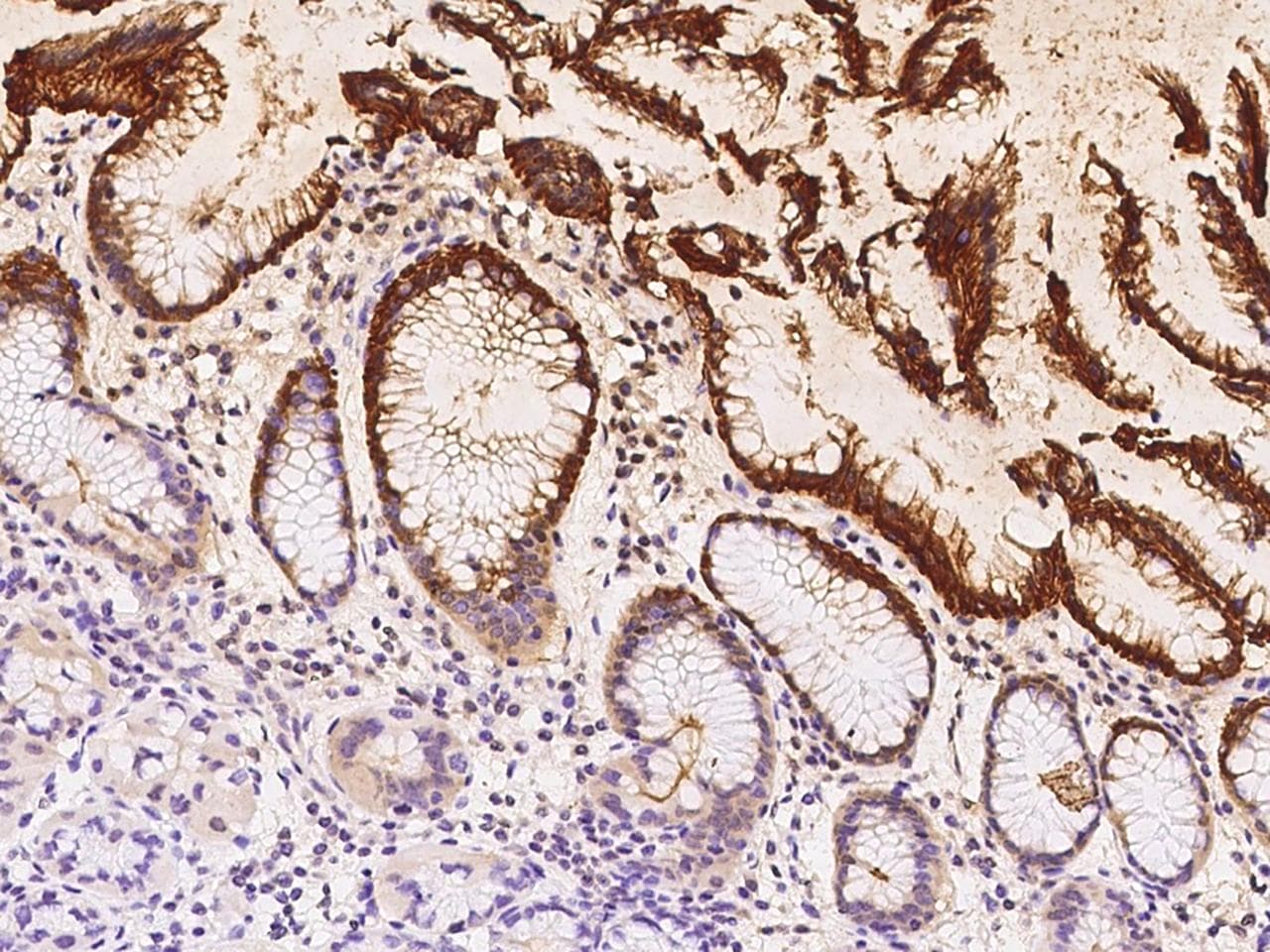 SLC5A5 / NIS Antibody