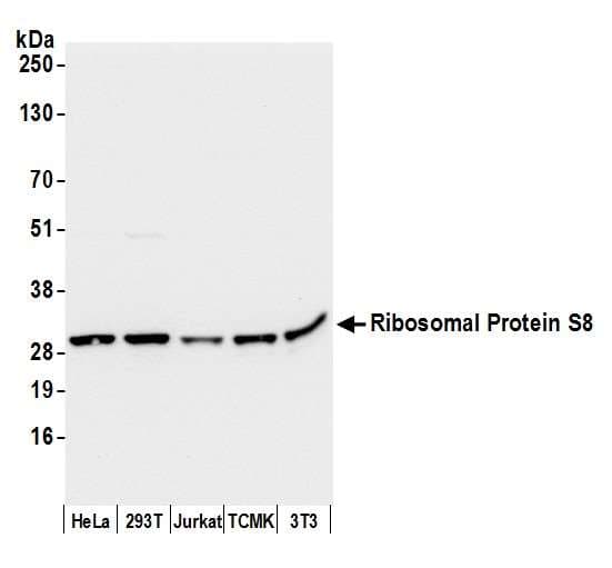 RPS8 / Ribosomal Protein S8 Antibody (aa158-208)