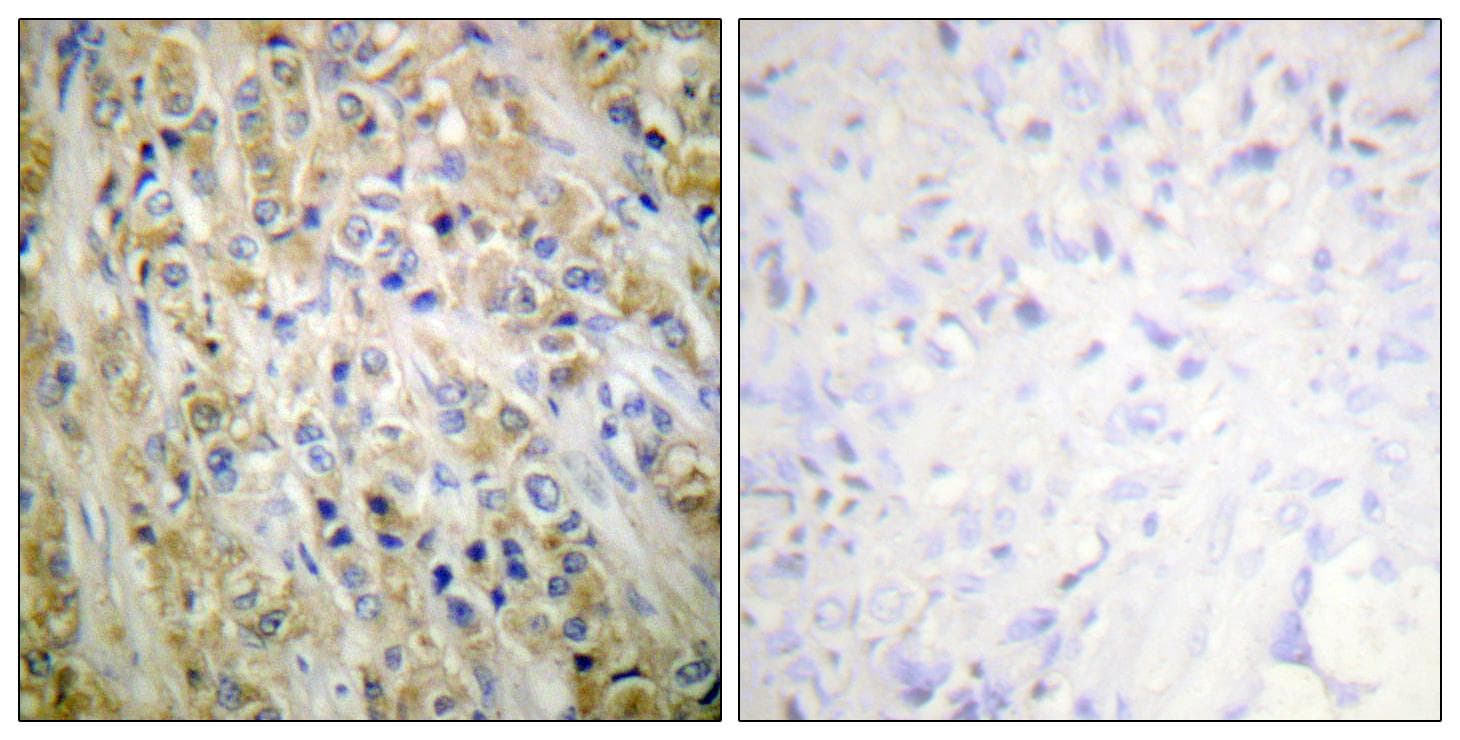 Polyclonal Rabbit anti-Human PSA-ACT Complex Antibody (IHC, WB)