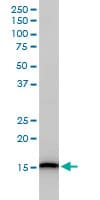UBE2D3 / UBCH5C Antibody (clone 4C1-1E3)