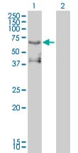 Monoclonal Mouse anti-Human PEA3 / ETV4 Antibody (clone 3G9-1B9, WB)