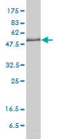 IHC-plus™ KPNA1 / Importin Alpha 5 Antibody (clone 2A4-1B5)