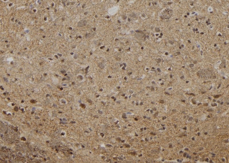 OIP5 Antibody