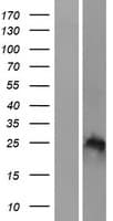 HOXB7 Protein (Over-Expression Lysate Myc-DDK (Flag))