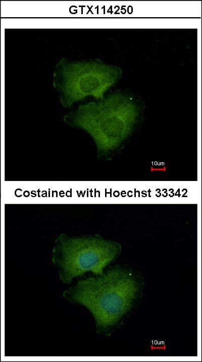 Polyclonal Rabbit anti-Human ALPPL2 Antibody (aa46-344, IHC, WB)