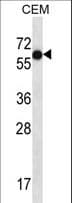 TFAP2B / AP2 Beta Antibody (aa431-462)