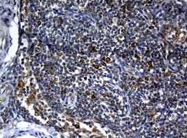 NBN / Nibrin Antibody (clone OTI3A2)