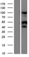 RPS21 / Ribosomal Protein S21 (Over-Expression Lysate Myc-DDK (Flag))
