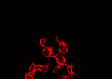 IGF1R / IGF1 Receptor Antibody (phospho-Tyr1161)
