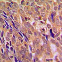 CHUK / IKKA / IKK Alpha Antibody (N-Terminus)