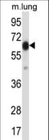 Polyclonal Rabbit anti-Human POF1B Antibody (aa337-366, WB)