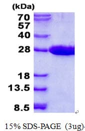 Human MRRF Protein (Recombinant His)