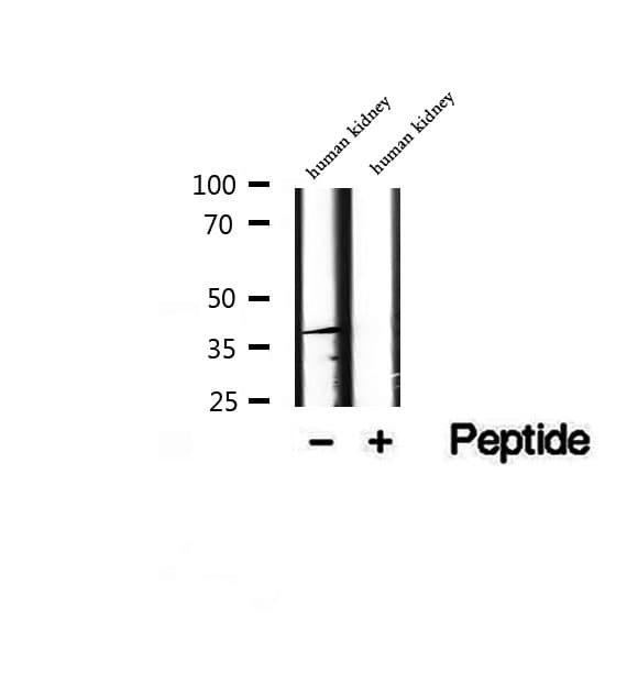 Polyclonal Rabbit anti-Human DYNC2LI1 / D2LIC Antibody (IHC, WB)