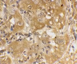 BCL2L11 / BIM Antibody (aa22-40)