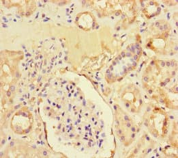 ZNF366 Antibody