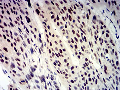 BTRCP / BETA-TRCP Antibody (clone 4C5D8)