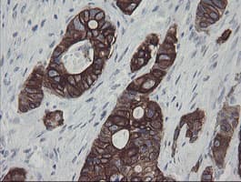SLA2 / SLAP2 Antibody (clone OTI3A7)