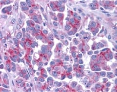 Polyclonal Rabbit anti-Human DIABLO / SMAC Antibody (IHC, WB)