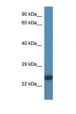 MYL6B Antibody (N-Terminus)