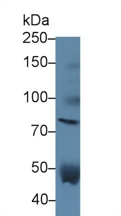 VCAN / Versican Antibody (aa2958-3209)