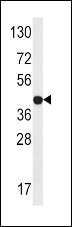 Polyclonal Rabbit anti-Human STRADA / LYK5 Antibody (aa364-393, WB)
