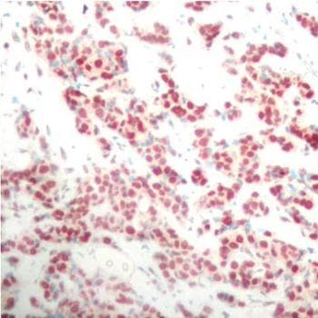 NFKB2 Antibody (phospho-Ser866)