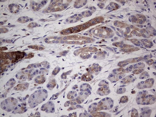 Monoclonal Mouse anti-Human PKM2 Antibody (clone 11B11, IHC, WB)